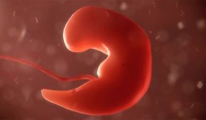 הפסקת הריון – מתי מדובר בעבירה פלילית?