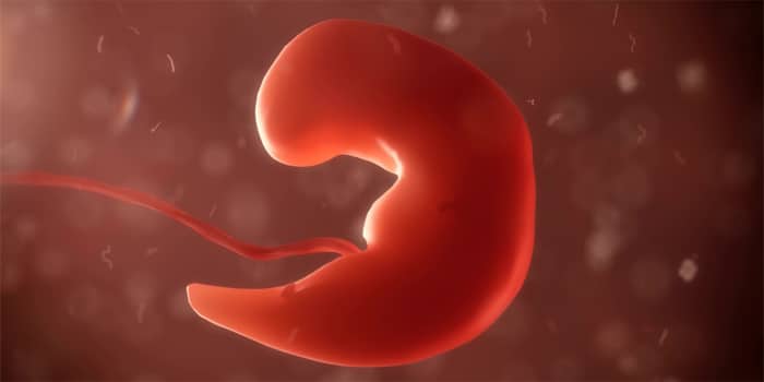 הפסקת הריון - מתי מדובר בעבירה פלילית?