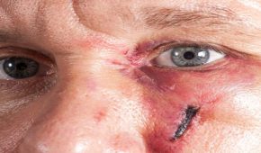 תקיפה חבלנית