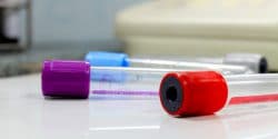 disease_spreading_crime_108521661