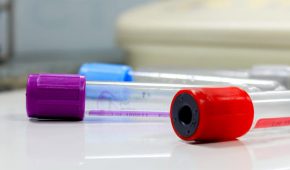 הפצת מחלה ברשלנות או במזיד – משמעותה והעונש בצידה