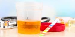 urine_test_452209481