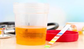 סירוב לבדיקת שתן בצבא – מה ההשלכות?