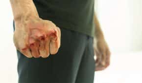 ביטול הרשעה ללקוח שתקף אדם אחר באגרופים וגרם לו לחבלות וחתכים בפנים